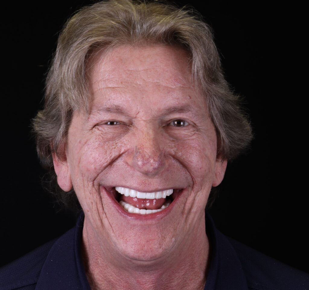 Smiling patient showing his new teeth from Anchored Dental Implants with all on x implants