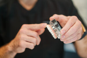 Dentist showing a model of whole-mouth implants