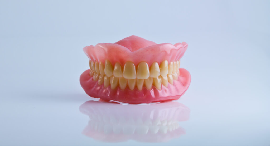 Why All-on-X implants or all-on-4 dental implants are better than traditional dentures